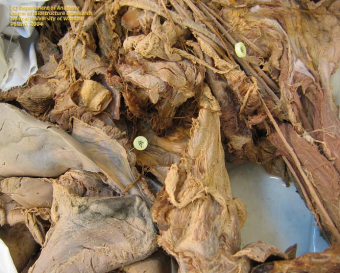 Szpilki -Grzbiet i kończyna górna - baz. n. axillaris sin.  16. diaphragma1.jpg